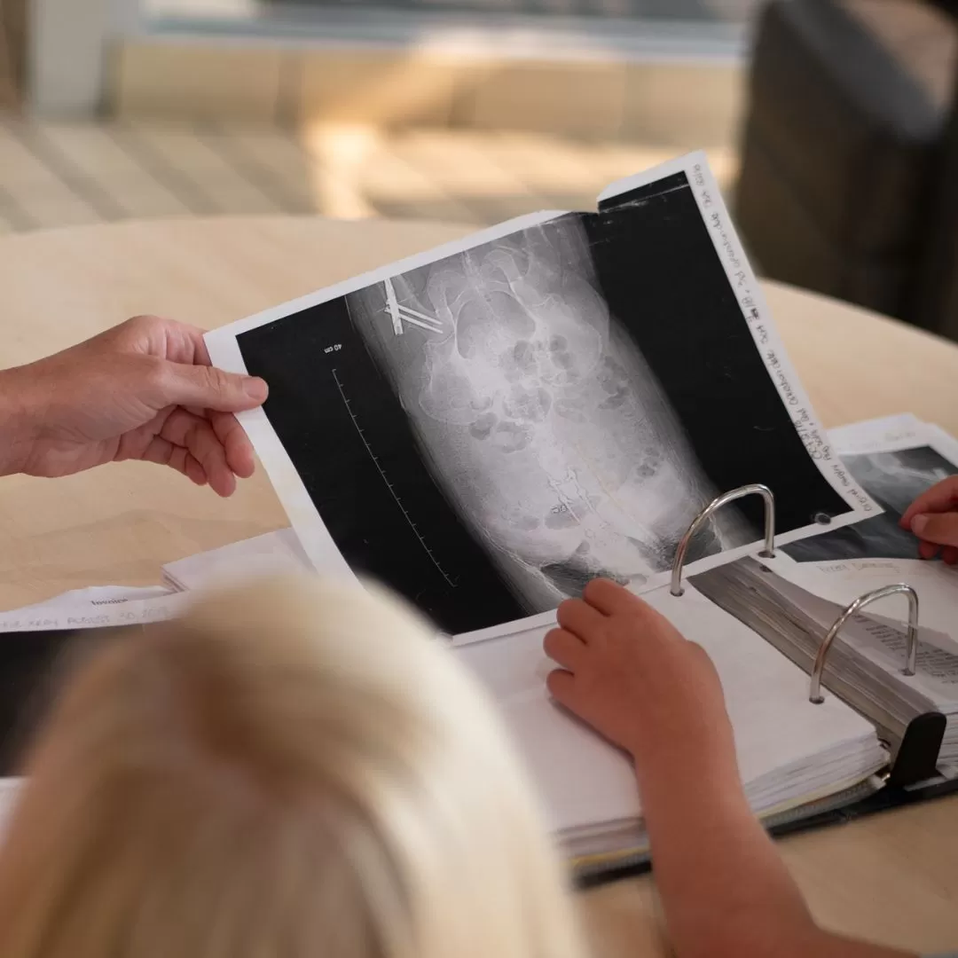 An x-ray photo with pins and screws is being help up in front of a table with a binder of other medial info. 